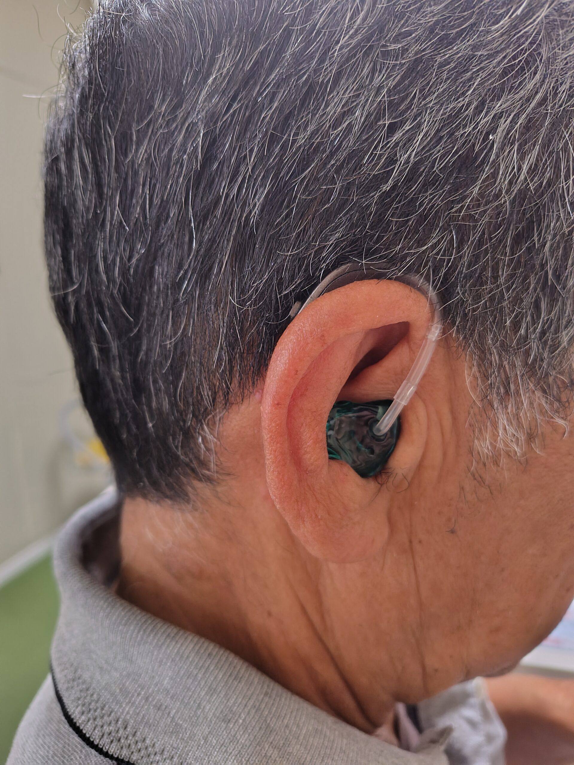 RU477-DWC（オムニア）【GNリサウンド】（松山はなみずき店）のサムネイル